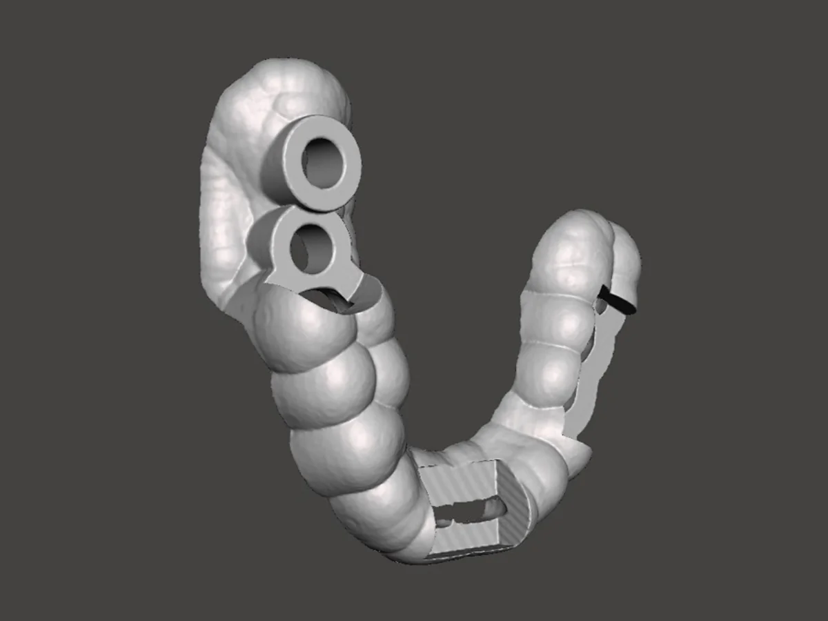 Navig&aacute;lt seb&eacute;szet