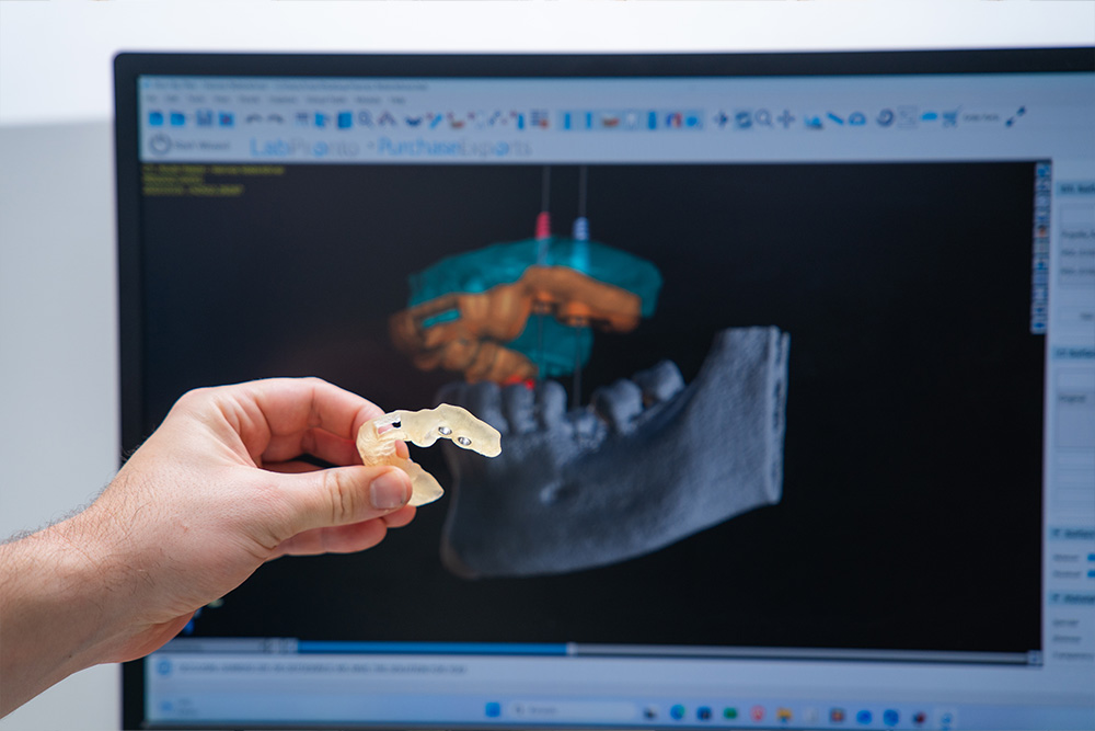 Digitális fogászat